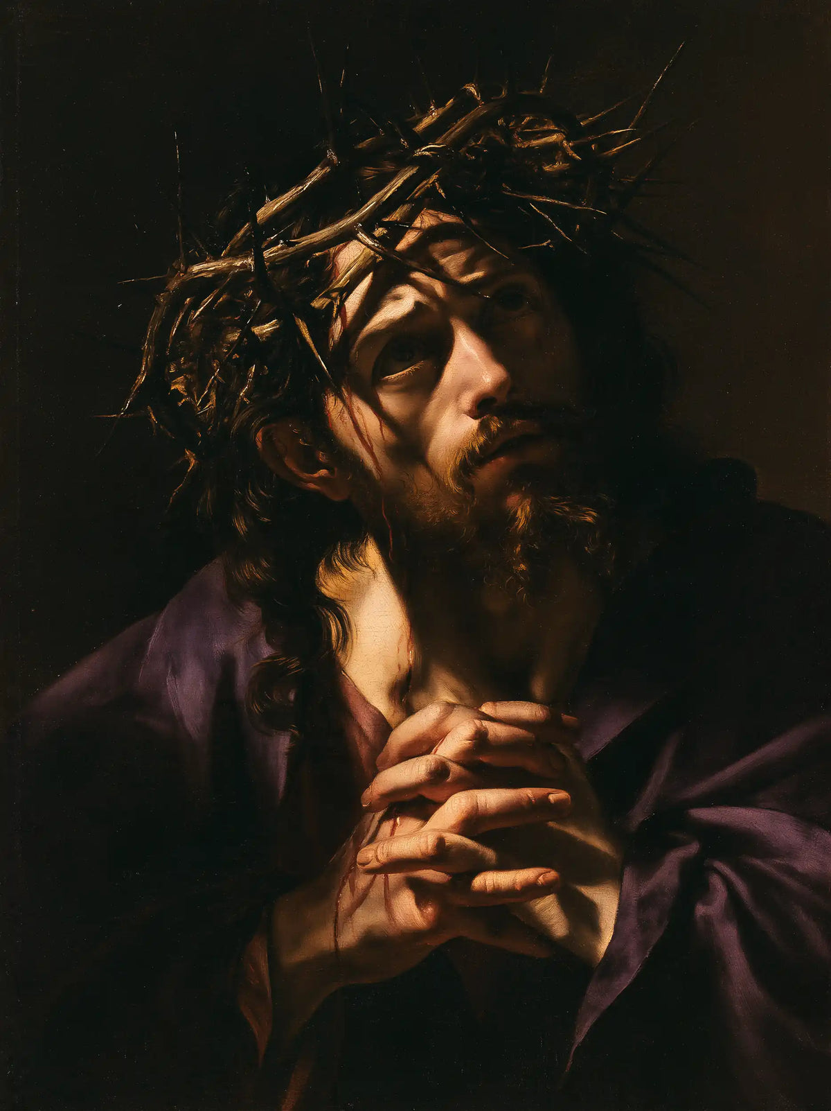 Jesus Crowned with Thorns — Joined Fingers beneath the Inclined Face
